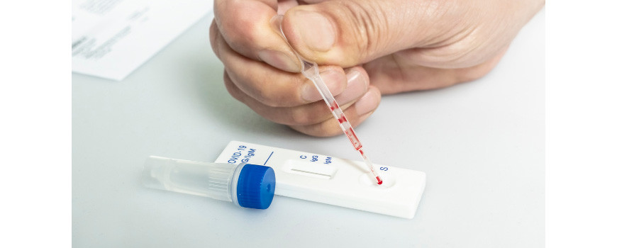 AUTOTEST ANTIGENIQUE A DISPOSITION CHEZ JPM